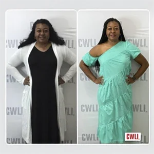 Before‑and‑after comparison showing a slimmer silhouette and enhanced confidence in fitted clothing